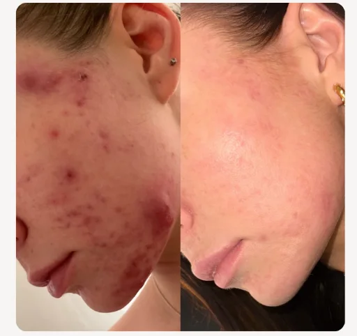 Client before and after, twelve weeks apart